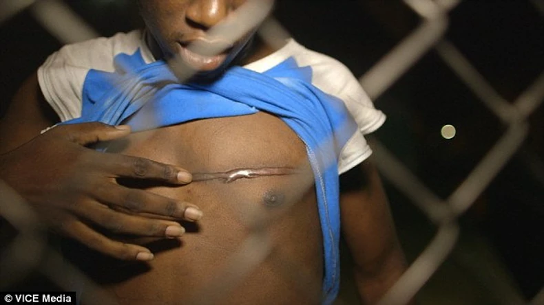 Posledice jednog od napada na gej osobe u Kingstonu