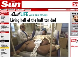 Był tak gruby, że mógł umrzeć