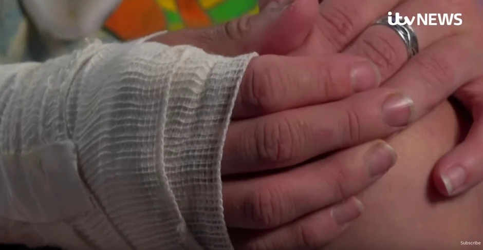 Džordžija je povredila ruku u incidentu