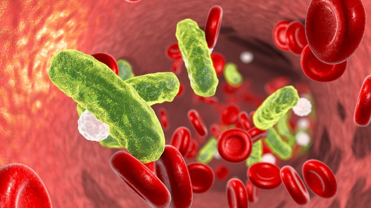 szepszis szülő gyilkos diagnosztizálás emberi történet