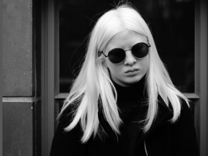 Najpoznatija albino manekenka