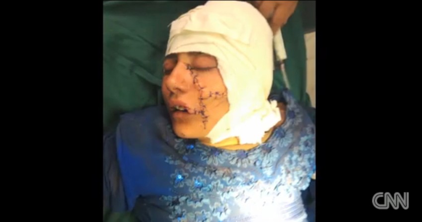 Dug i težak oporavak. Često pomisli da bi joj bilo bolje da je umrla i strepi od neizvesne budućnosti