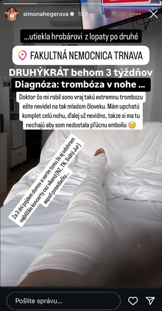 Simu hospitalizovali v nemocnici kvôli trombóze v nohe.