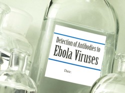 Czy Polska jest przygotowana w razie przypadku Eboli?