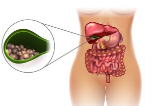 Porcelanska žučna kesa