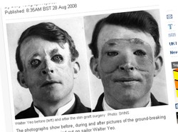 On pierwszy miał operację plastyczną