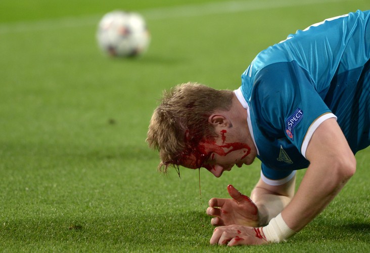 Tak Robert Lewandowski 'urządził' rywala. Hubocan zalał się krwią