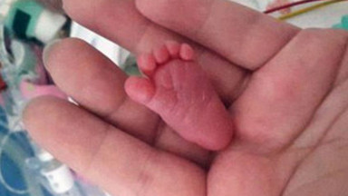 Emilia Grabarczyk najmniejszym noworodkiem świata. Urodziła się w niemieckim szpitalu