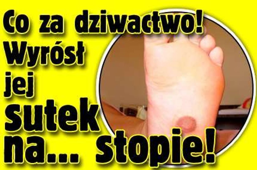 Wyrósł jej sutek na... stopie!