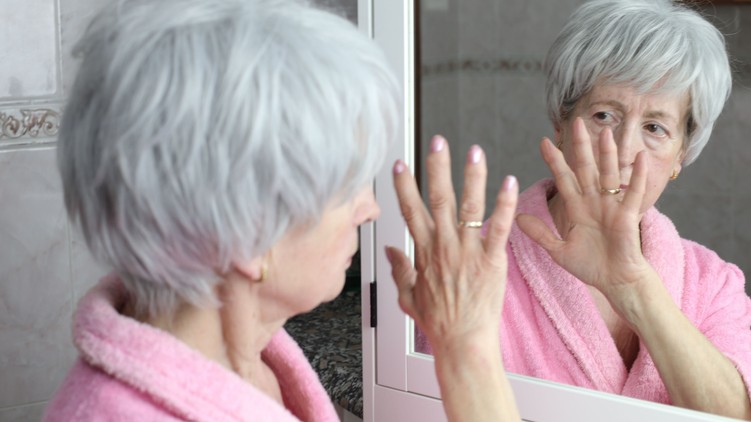 tévhit demencia Alzheimer-kór időskor memória