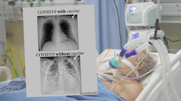 Płuca po COVID-19 u zaszczepionych i niezaszczepionych