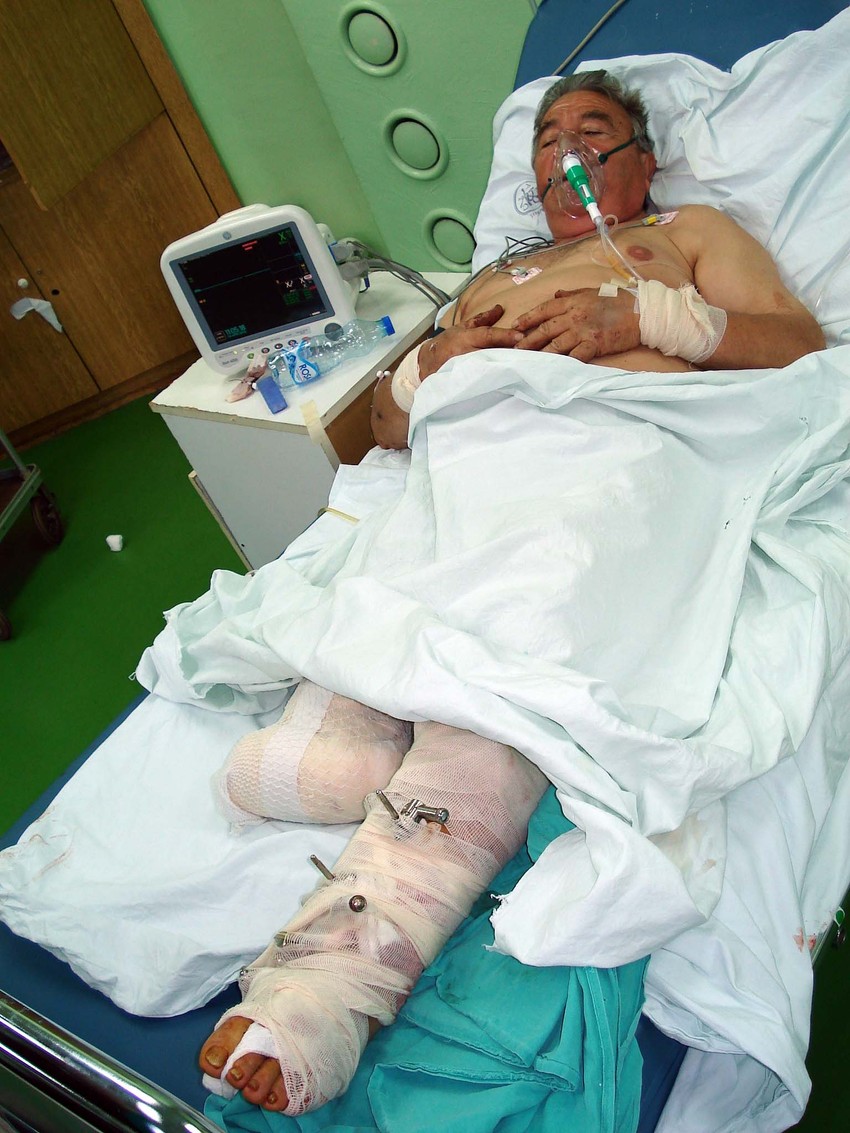 Povređeni Zoran Tošić