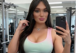 Ana Nikolić nakon promene pola