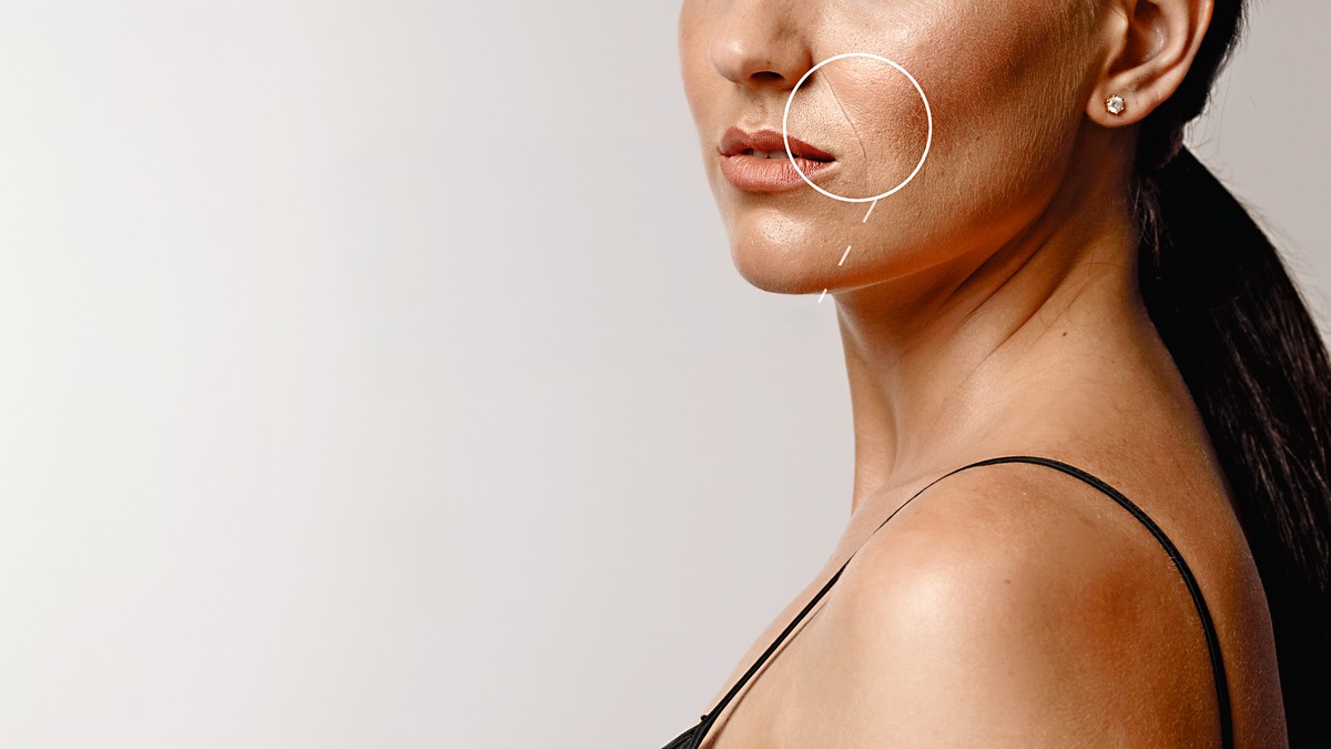 Ove bore se prve pojavljuju na licu i odaju godine