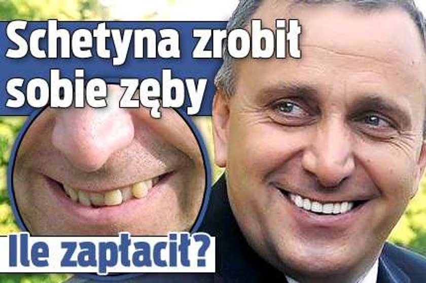 Schetyna zrobił sobie zęby. Ile zapłacił?