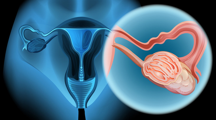 A betegek felénél összement a tumor a kezelés hatására /Illusztráció: Northfoto