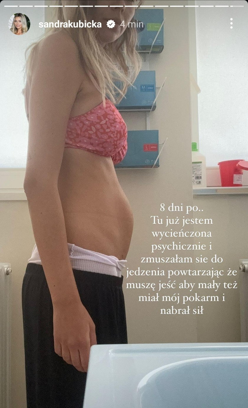 Sandra Kubicka osiem dni po porodzie. 