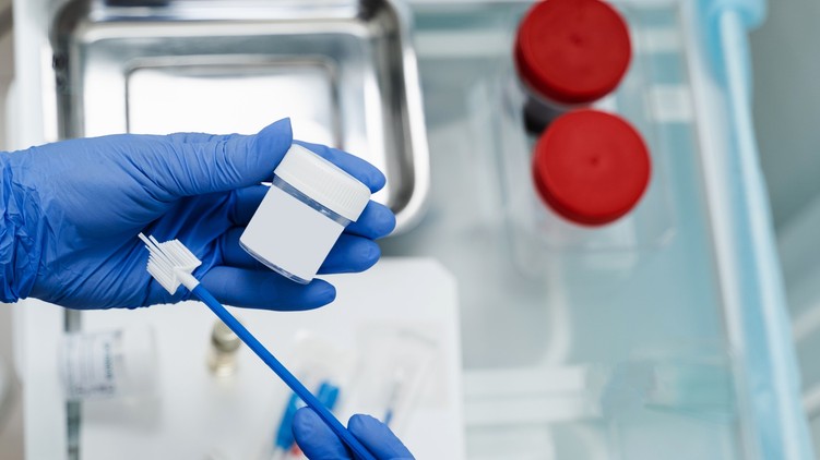 barna hüvelyi folyás HPV szűrés nőgyógyász orvos válaszol