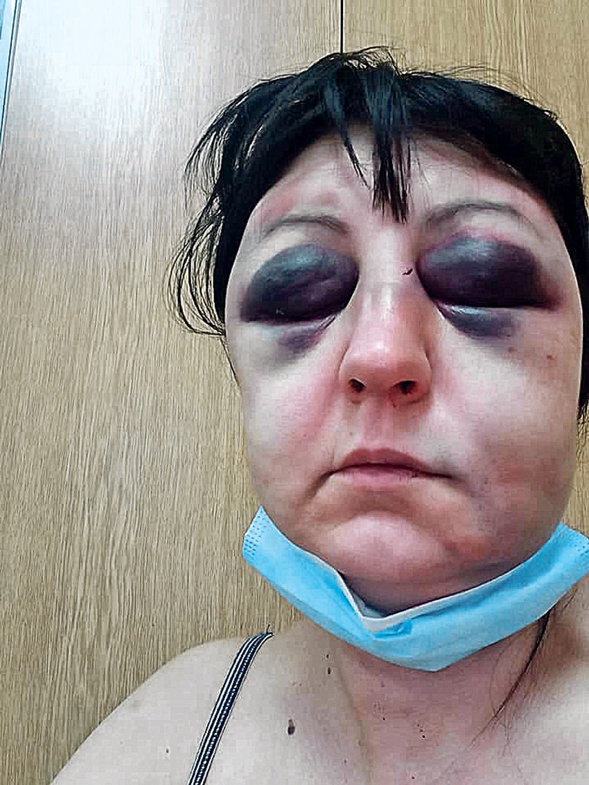 Pravnicu D. R. iz Šapca prebio taksista koji je godinama progoni