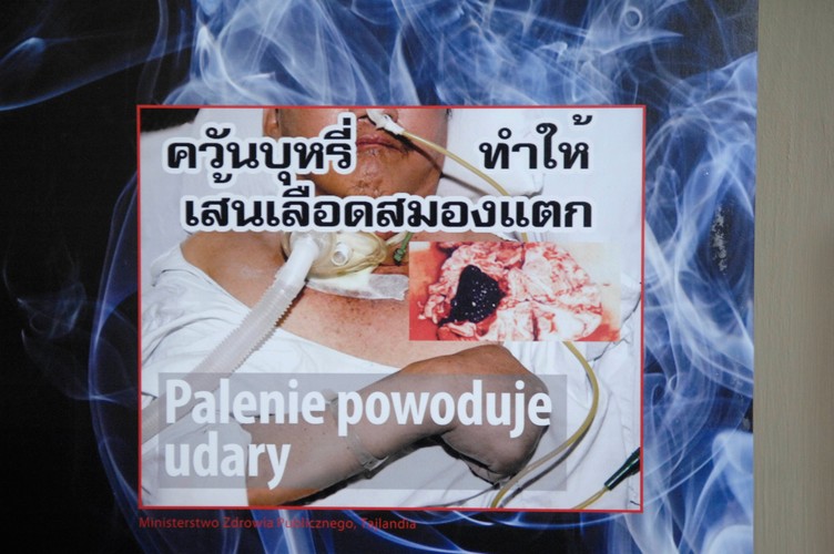 Z okazji Światowego Dnia Bez Tytoniu ministerstwo zdrowia zorganizowało wystawę grafik, jakie w różnych krajach straszą z paczek papierosów