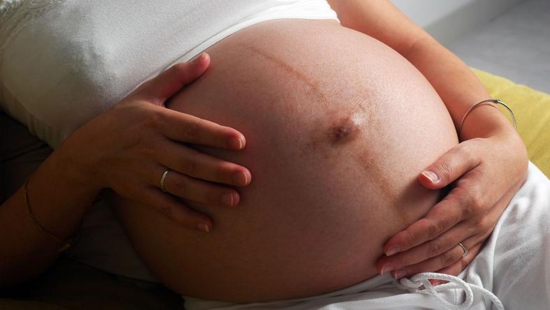Here are rashes that could occur during pregnancy second ...