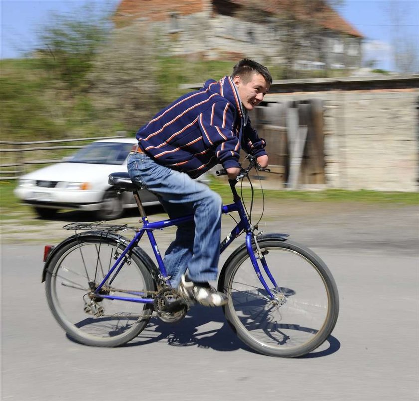 Żyje dzięki protezom