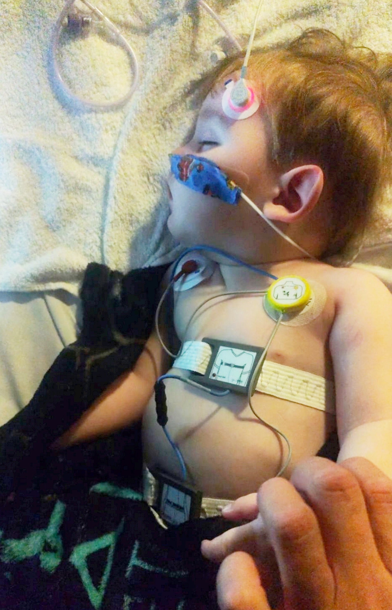 Na Oli-Jayovu chorobu v súčasnosti neexistuje liek.