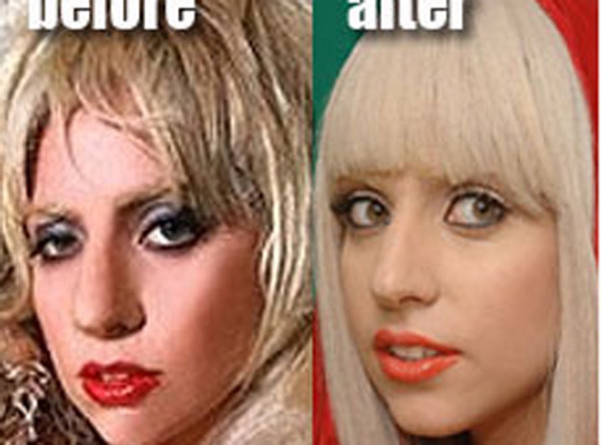 Lady GaGa przed operacją plastyczną