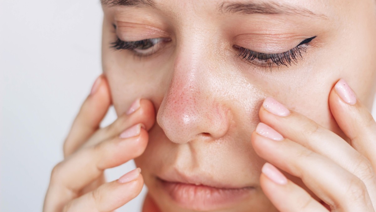 Sam nazalni vestibulitis nije zarazan, ali mikrobi koji ga izazivaju jesu