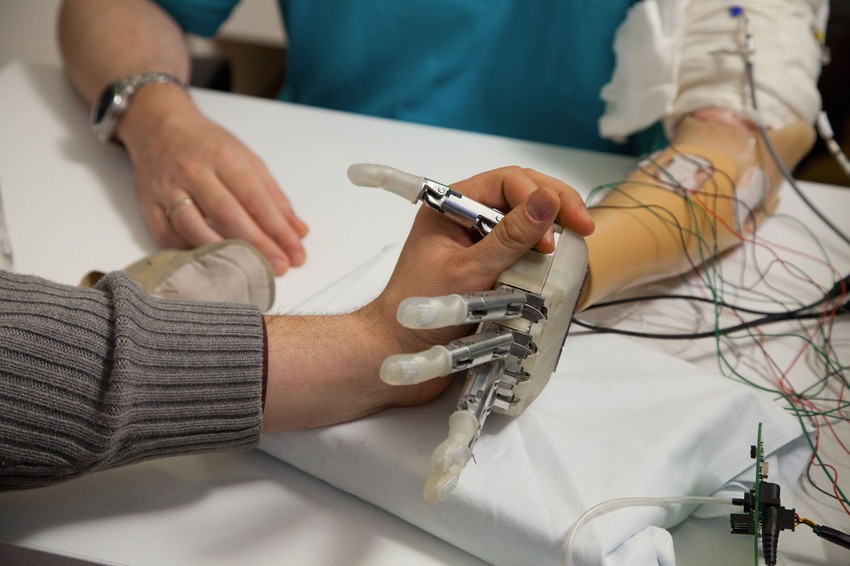 Bionička ruka/Foto:EPFL press