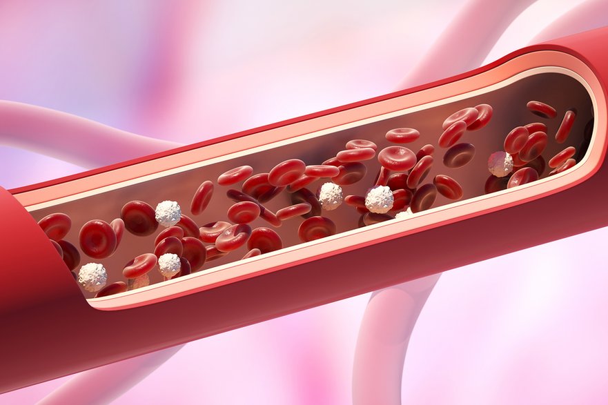 Wysoki poziom cholesterolu to jedna z częstych przyczyn chorób serca i układu krążenia