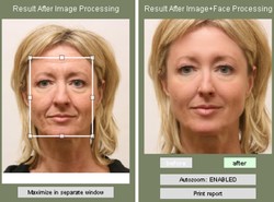 Zanim Cię potną, zobacz, jak będziesz wyglądać