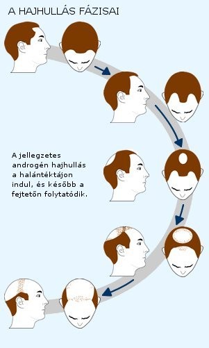 hajhullas-nagy-d000001EC91bf9122a677
