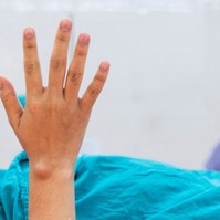 Bőr alatti csomó - így tudhatja meg, hogy jó- vagy rosszindulatú az elváltozás
