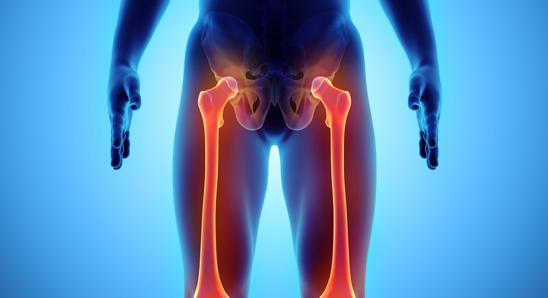 A 3D medical illustration of femur bones in the leg.