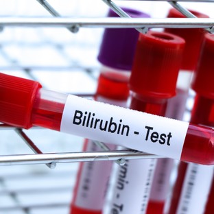 Mit jelent a bilirubin érték a laborleleten?