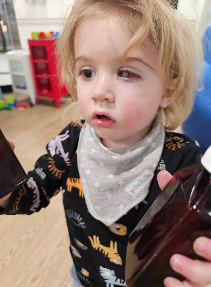 Choroba sa na Juwona mohla preniesť bozkom.