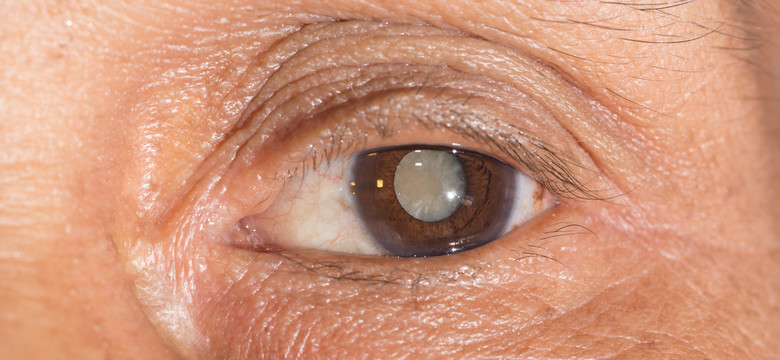 Witamina C może zapobiec zaćmie - chorobie, która grozi utratą wzroku