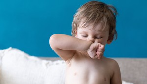 Alergijski pozdrav je karakterističan pokret kojim se trlja nos dlanom odozdo prema gore