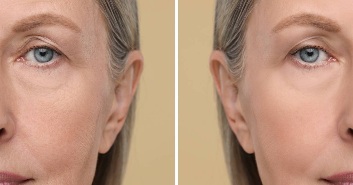 To serum to potężna dawka nawilżenia! Papierowe zmarszczki znikają już po 1. użyciu!