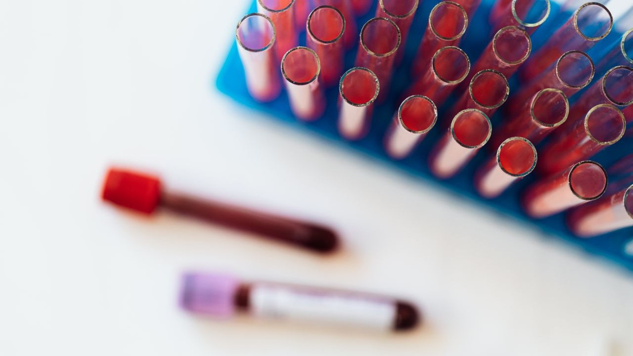 Când oboseala nu trece: analizele care merg dincolo de hemoleucogramă, la Synevo