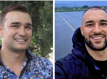 Haris Berković pre i posle presađivanja kose: Da je znao šta ga čeka dvaput bi razmislio da li da se opredeli za tako bolnu proceduru!