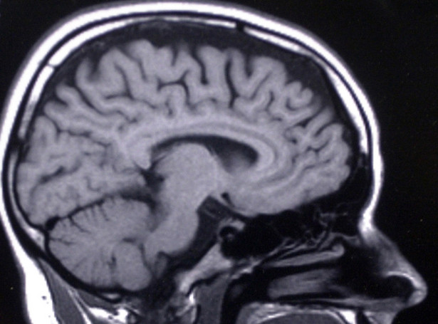 Naukowcy znaleźli w mózgu miejsce poczucia winy