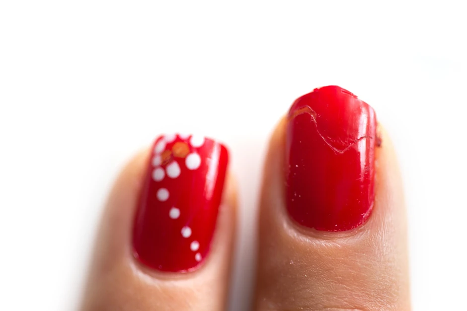 nokti slomljen shutterstock 266479175