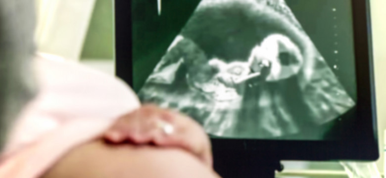 USG w ciąży – czy istnieje limit?
