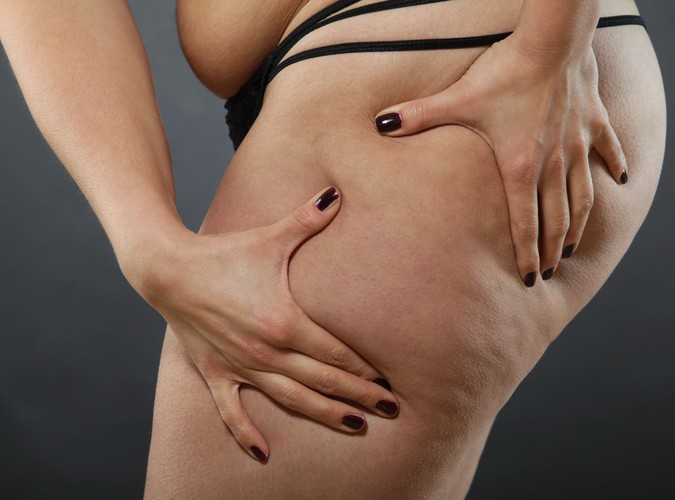 Cellulit cellulitowi nierówny