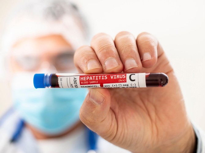 Ovo su mitovi o hepatitisu