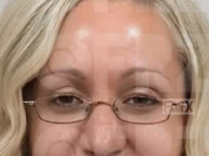 Šta se krije iza neverovatnih transformacija žena koje su odlazile kod poznatog turskog plastičnog hirurga