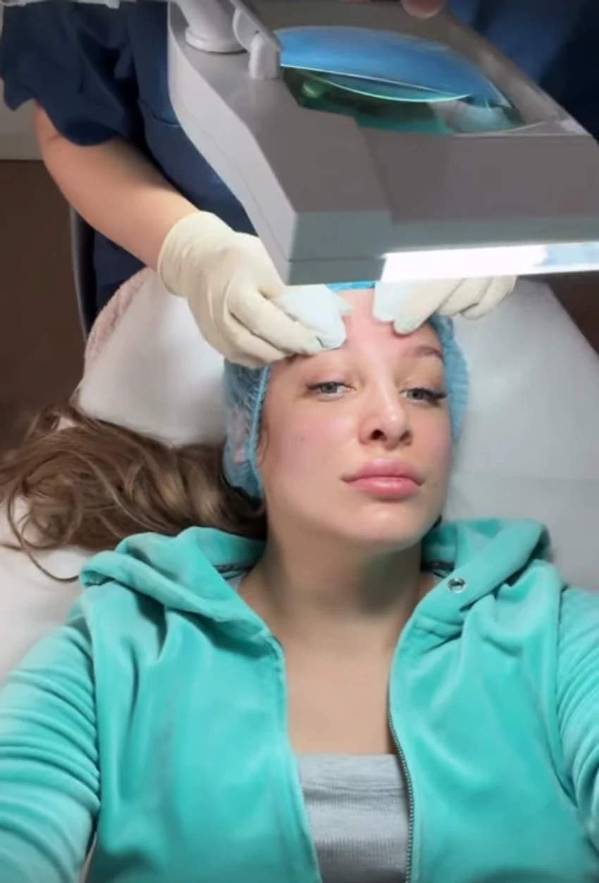 Luna Đogani otišla na podmlađivanje lica, snimila ceo proces kod kozmetičara