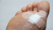 Kurzajka na stopie - przyczyny, leczenie, domowe sposoby na kurzajki na stopach